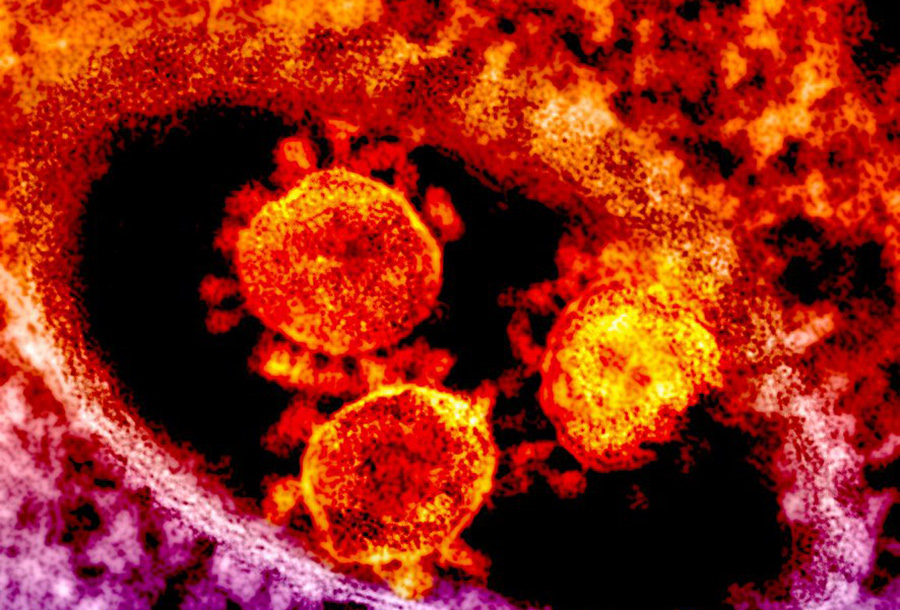 As+the+coronavirus+spreads+across+the+United+States%2C+all+citizens+are+recommended+to+stay+at+home+in+a+self-quarantine.+Because+this+would+make+it+impossible+to+go+to+school+and+participate+in+extra-curricular+activities%2C+Georgia+high+schools+have+resorted+to+online+learning+and+have+had+no+choice+but+to+cancel+standardized+testing+this+spring.